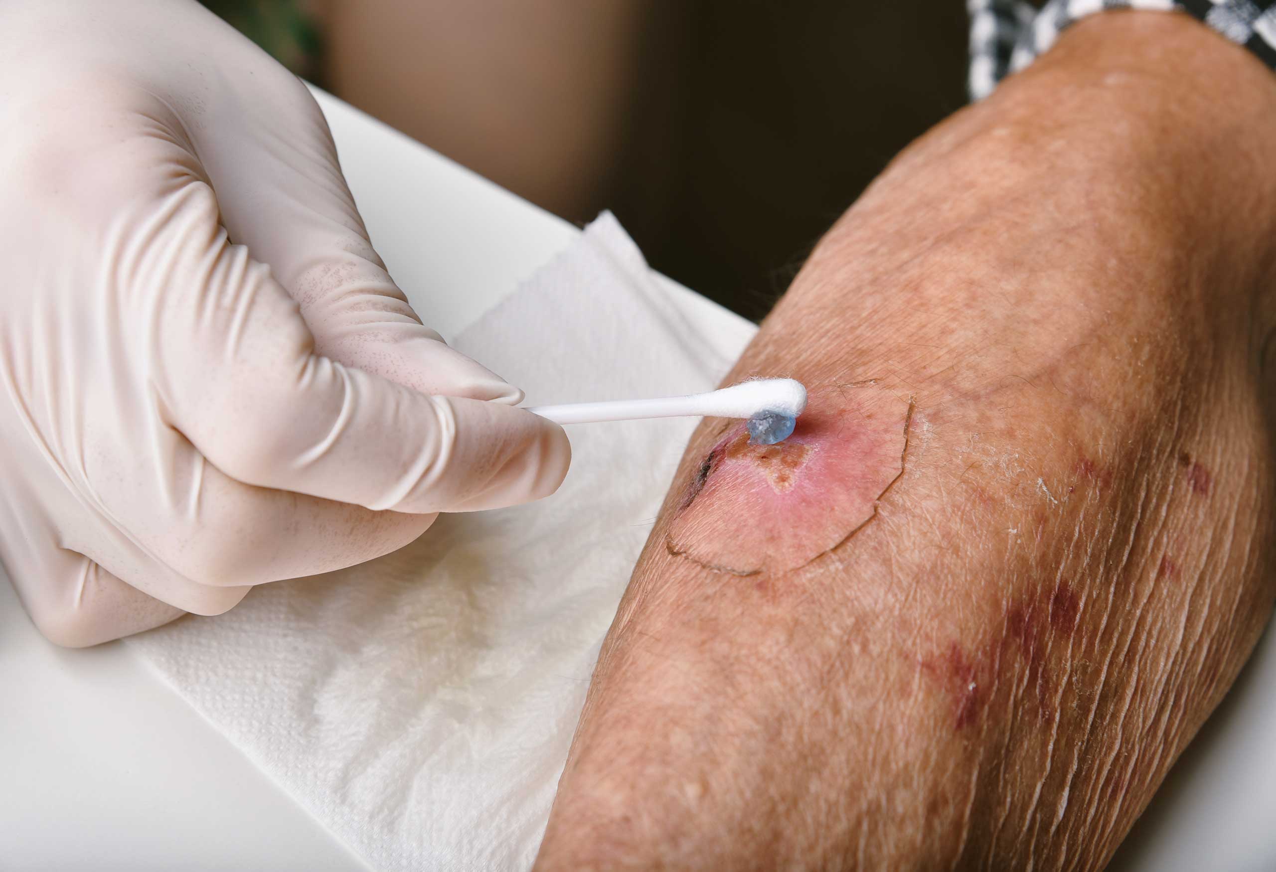 Skin and Wound Care Consultancy